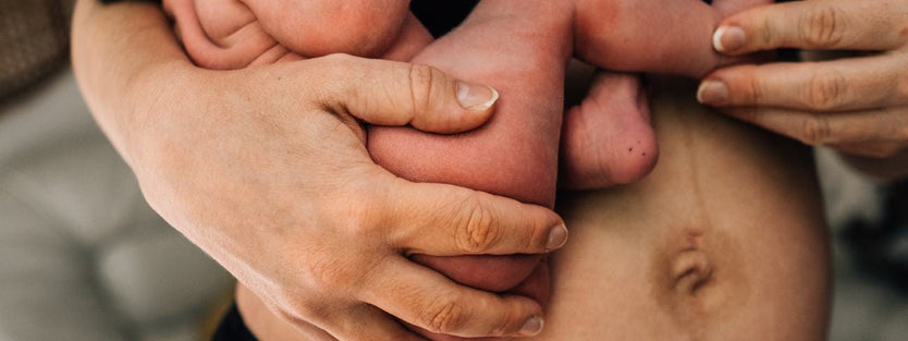 Newborn on mums arms next to her postpartum belly