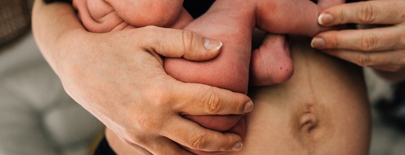 Newborn on mums arms next to her postpartum belly